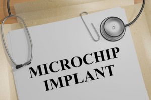 microchip implant
